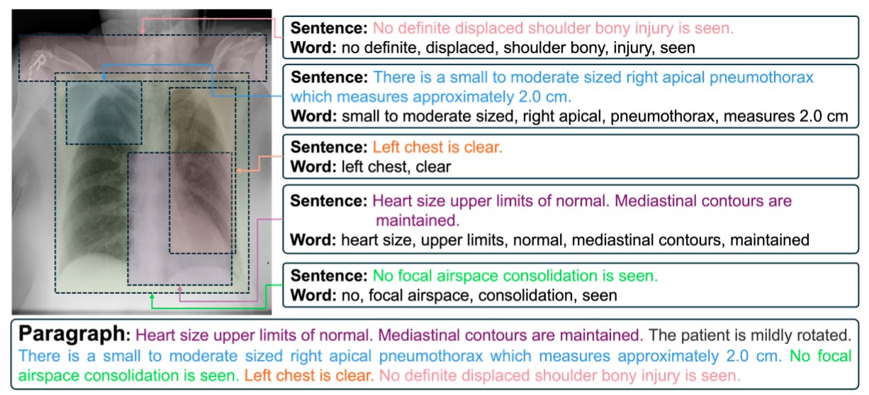 Motivation: Multi-level visual-textual alignment in radiology reports